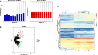 Identification of the Crucial Gene in Overflow Arteriovenous Fistula by Bioinformatics Analysis